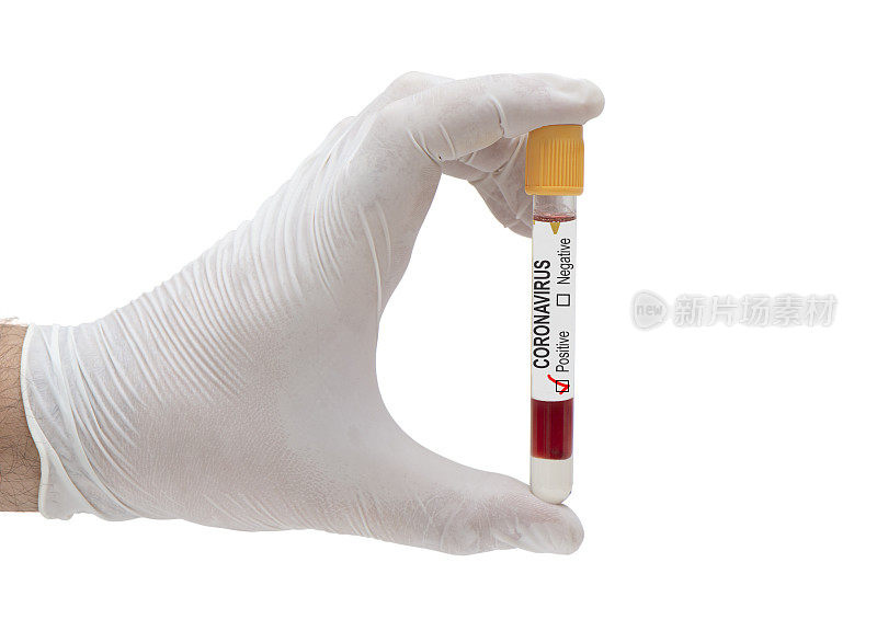 手握冠状病毒阳性血液样本