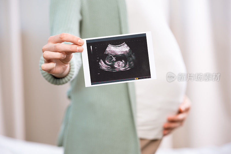 孕妇抱着宝宝的超声波扫描，摸着肚子