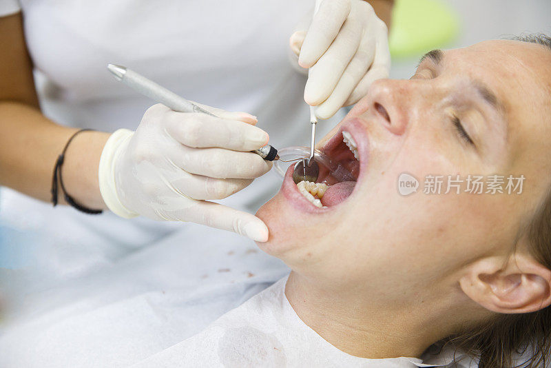 牙科卫生员办公室的病人