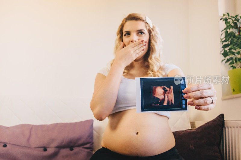 孕妇抱着宝宝的3D超声波照片