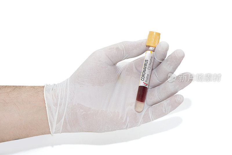 手握冠状病毒阳性血液样本