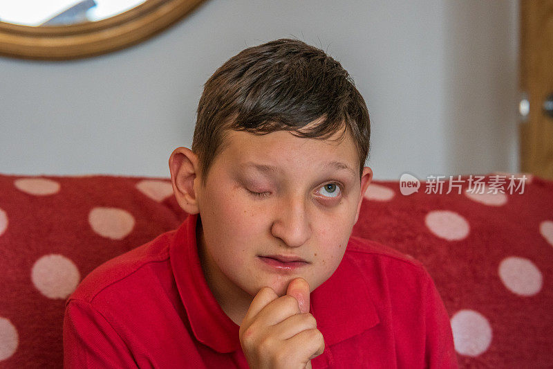 残疾部分失明的男孩肖像