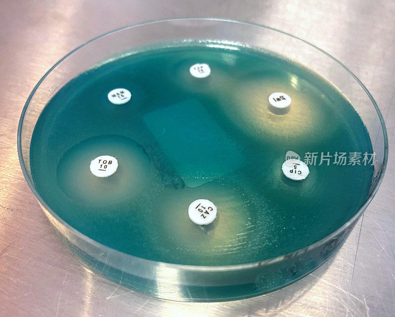 假单胞菌aeroginosa。医院废水中含有来自医院病人的耐药细菌。