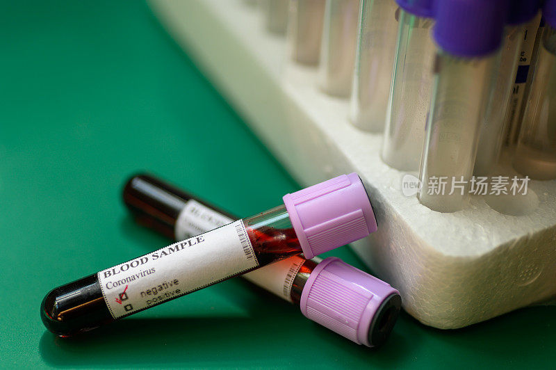 冠状病毒血液样本在实验室管和听诊器