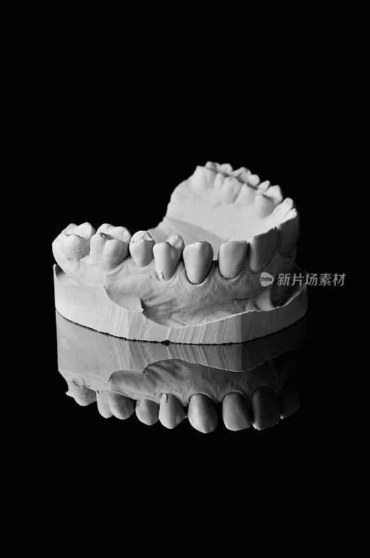 牙科铸造模型