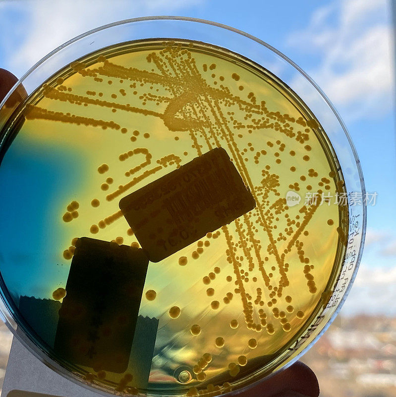 大肠杆菌生长在对着天空的琼脂培养皿上。