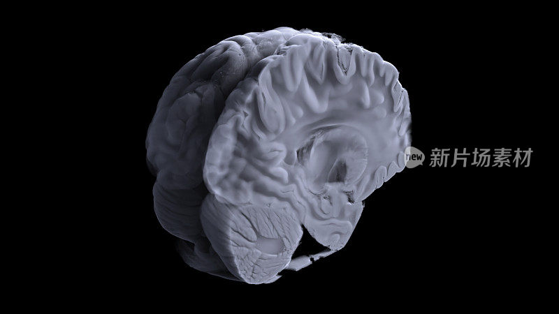 利用MTR和断层摄影技术对人类大脑进行三维可视化的数字研究，展示了我们大脑的工作，它的功能，以及它的工作与人类神经系统和身体其他系统的关系