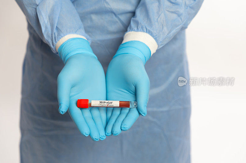 医生在白色背景的试管中拿着阳性冠状病毒样本