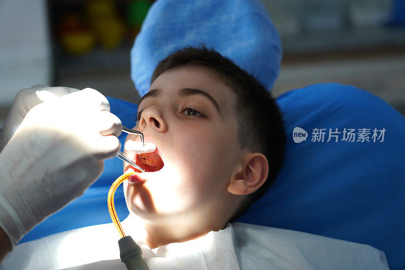 正在接受牙科治疗的男孩
