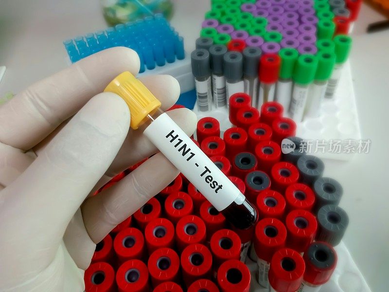 甲型H1N1流感病毒血液样本
