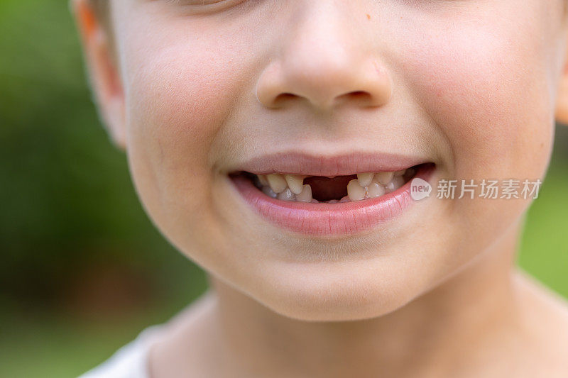 特写照片微笑的学龄缺口牙齿的男孩少了四颗门牙