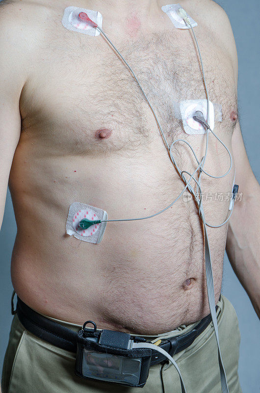50岁男性，5个传感器，动态心电图