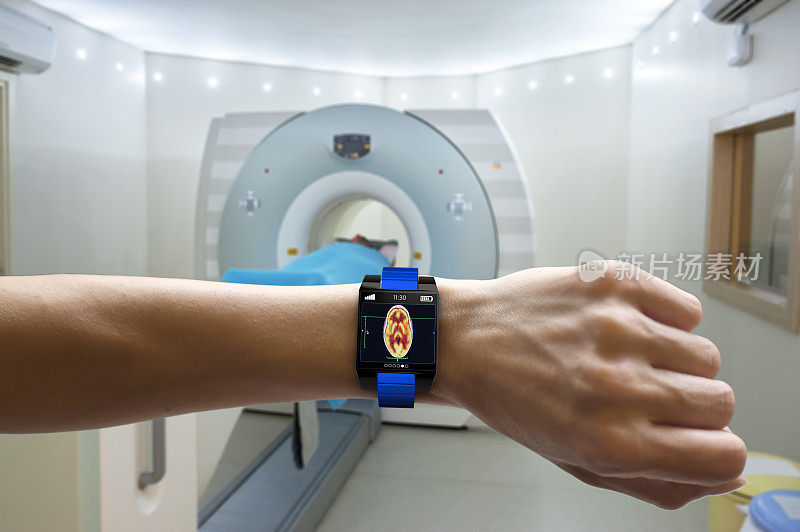 智能手表应用医疗扫描
