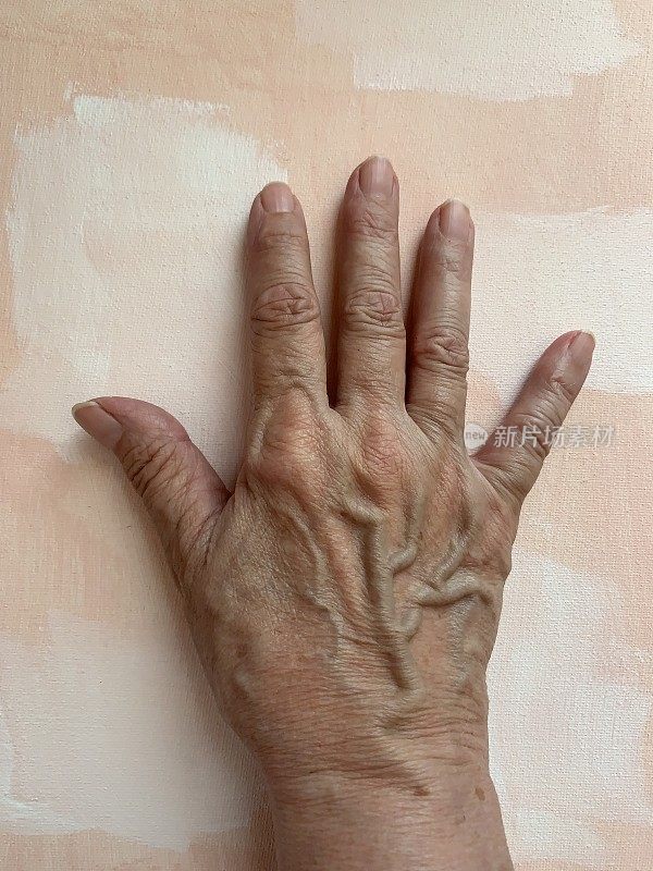 手和手腕疾病