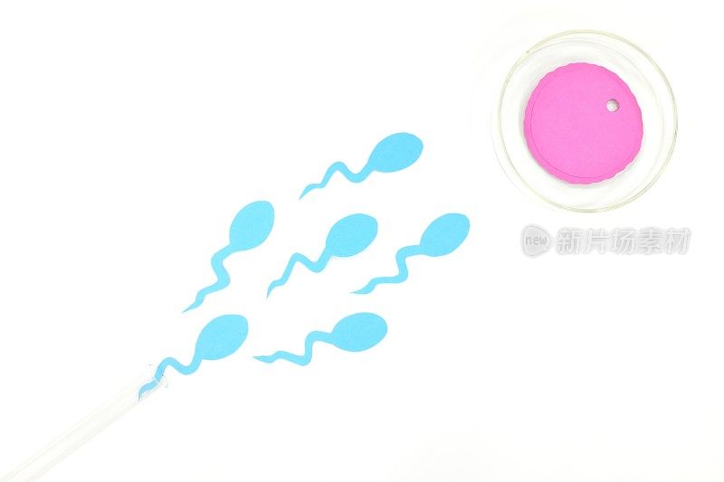 体外受精概念。试管和培养皿中的精子和卵细胞。