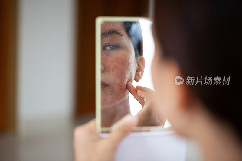 女性面部粉刺和问题皮肤的概念镜头。