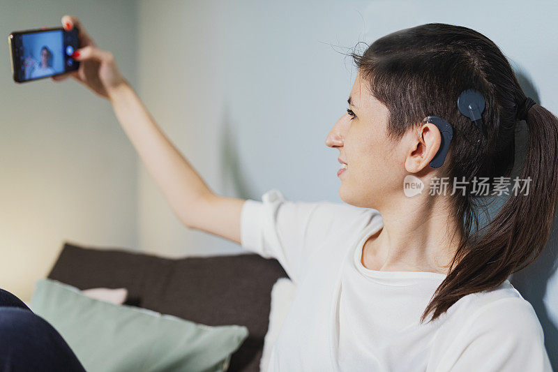 漂亮的年轻女子，植入了耳蜗