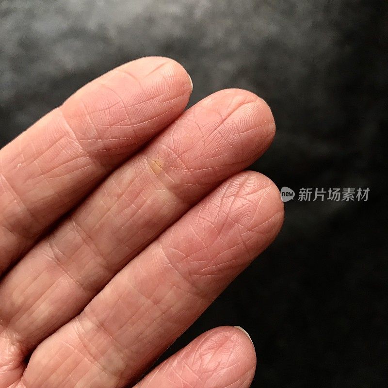 衰老的手有皱纹和拇指关节炎