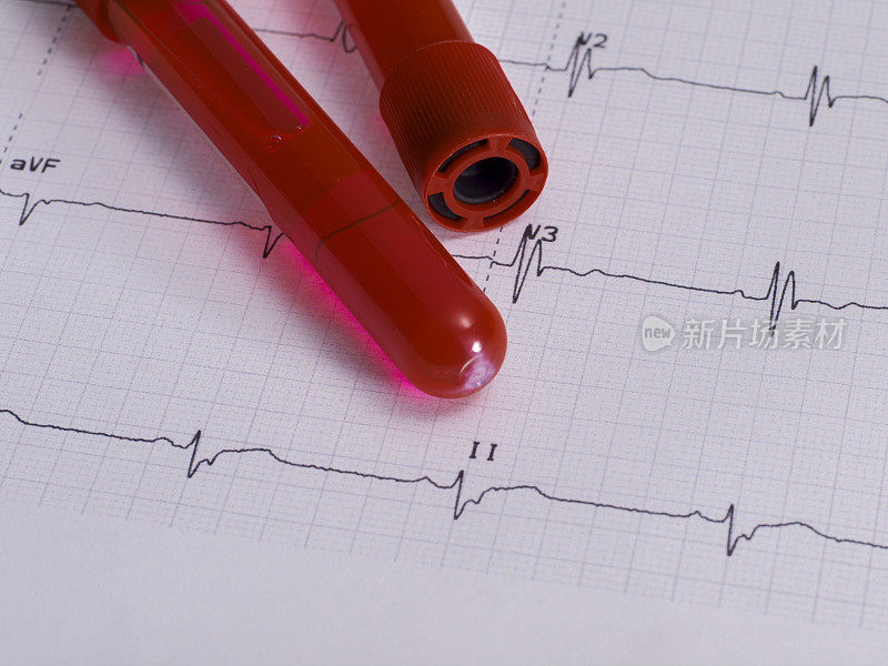 真实心电图和新型冠状病毒血试管没有人。