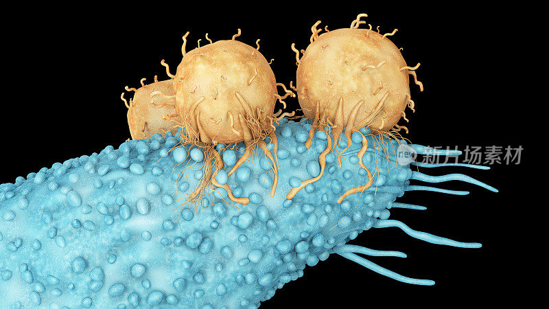 T淋巴细胞(T细胞)和癌细胞