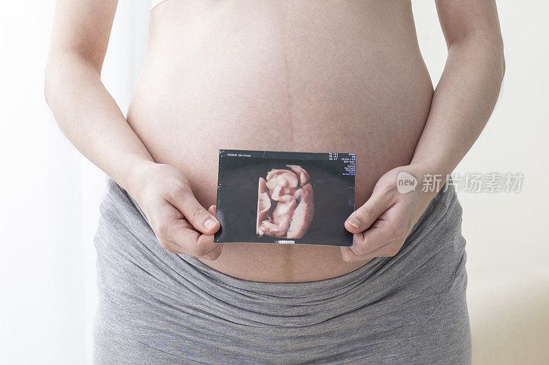 孕妇拿着超音波影像站着