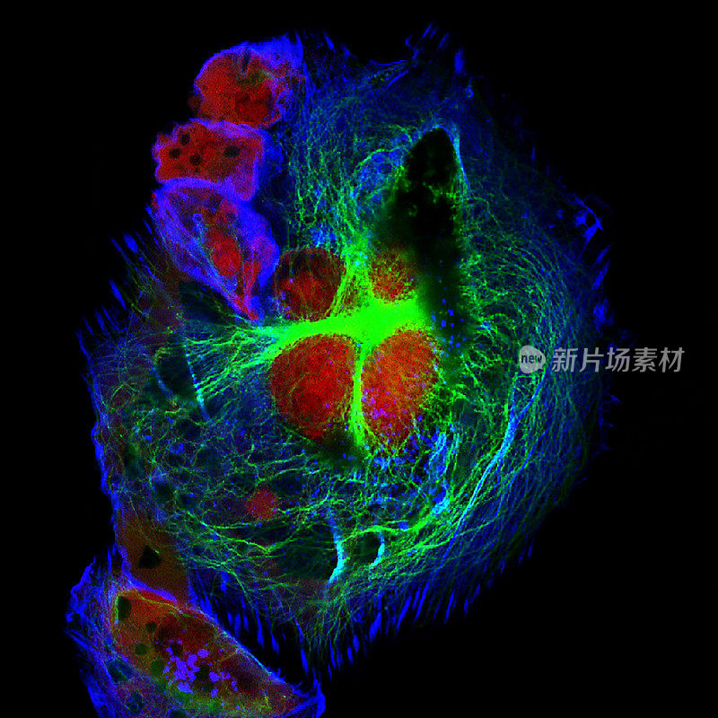 人类神经母细胞瘤细胞的真实荧光显微镜图