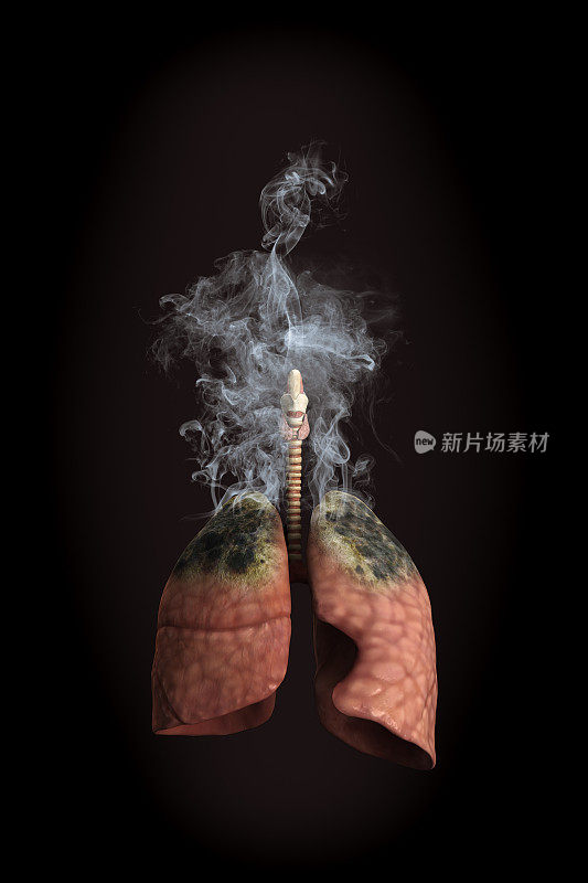 吸烟肺