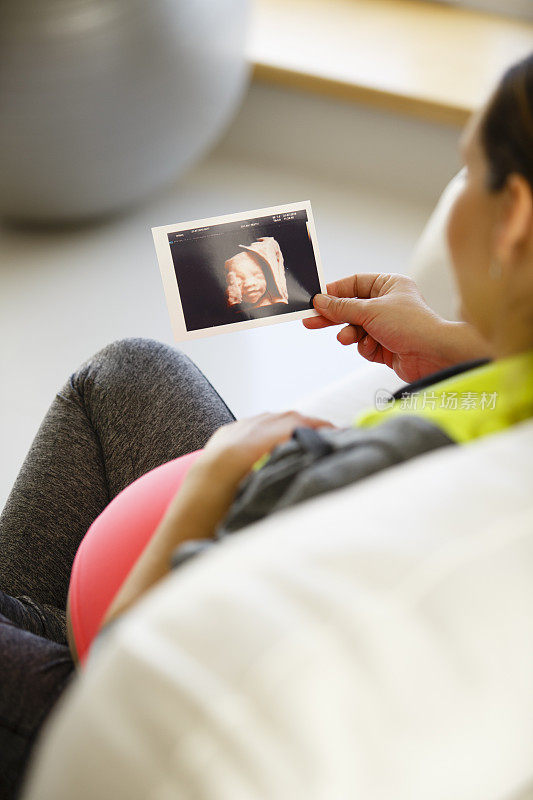 一名孕妇正在看她孩子的超声波照片