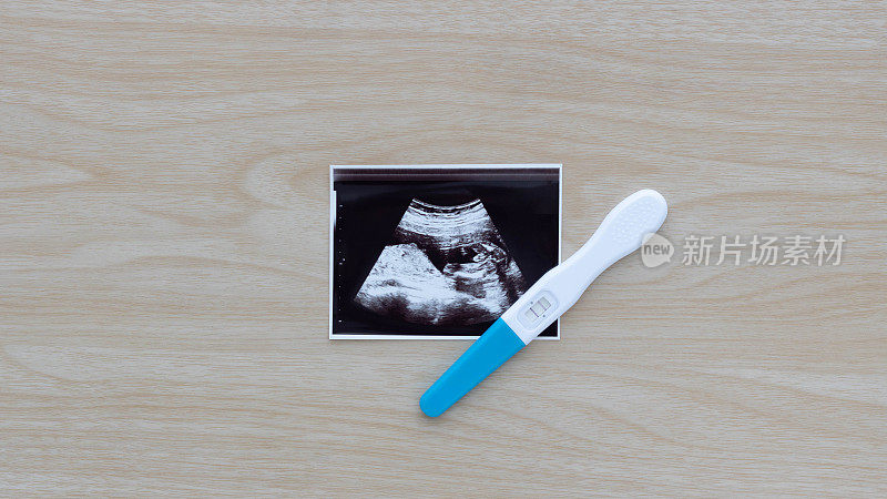 妊娠检查显示阳性结果，超声图像婴儿分离在木制背景。超声检查结果，孕期超声检查结果。孕期保健的概念。