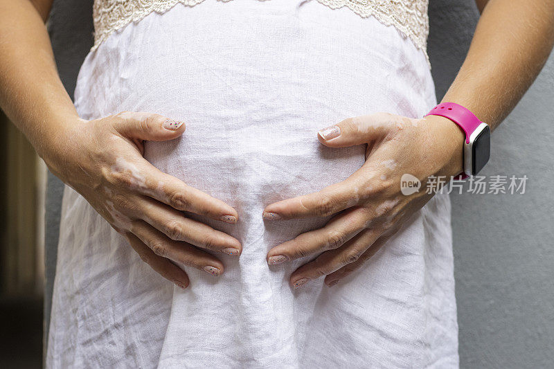 孕妇抱着她的肚子，靠近白癜风的手。