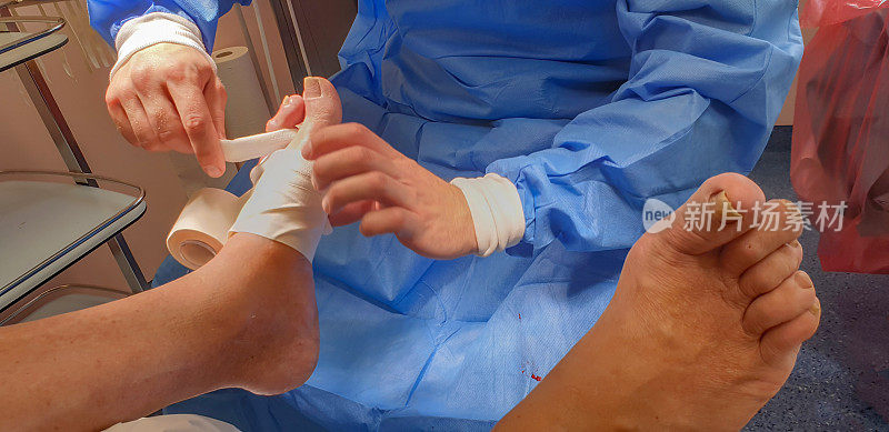 外科医生给脚趾做手术并包扎