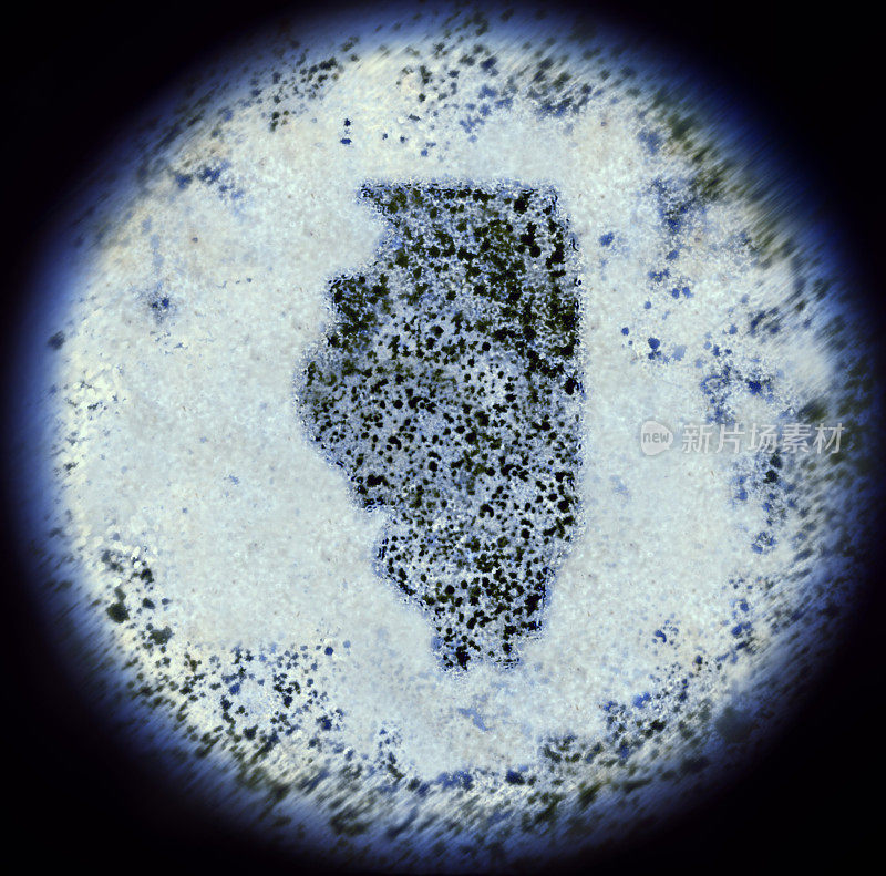 通过显微镜观察形成伊利诺伊的细菌(系列)