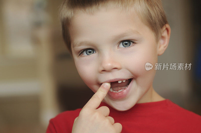 小男孩掉了两颗牙