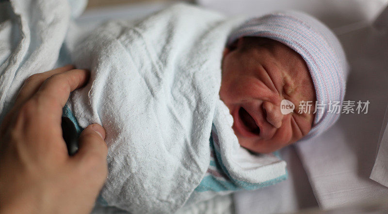 刚出生的男婴哭了。