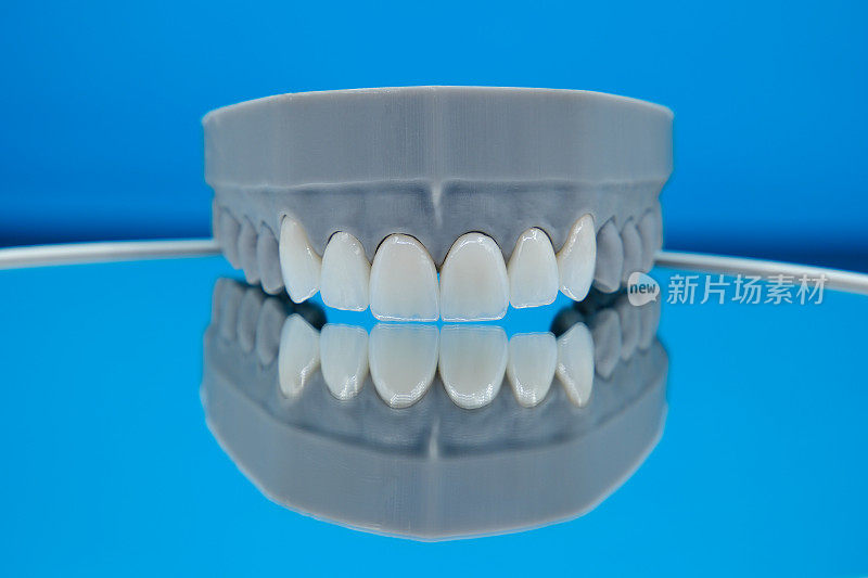 为高档牙科诊所制作的贴面牙模型