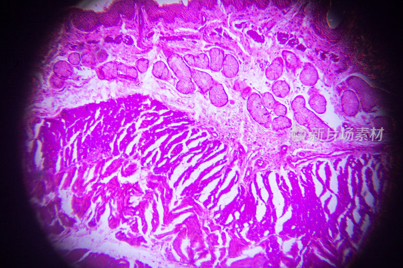 显微镜下食管横切面组织