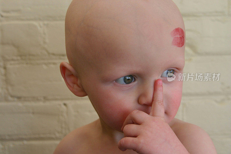 癌症的孩子;一个吻让一切变得更好