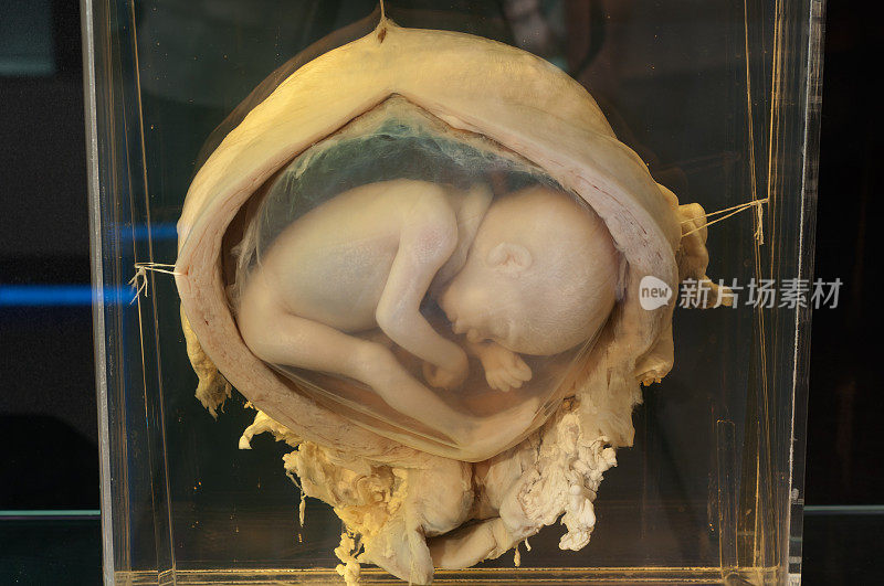 子宫中的六个月人类胎儿