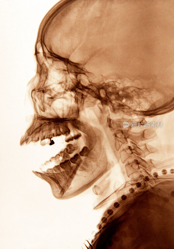 头部x光图像