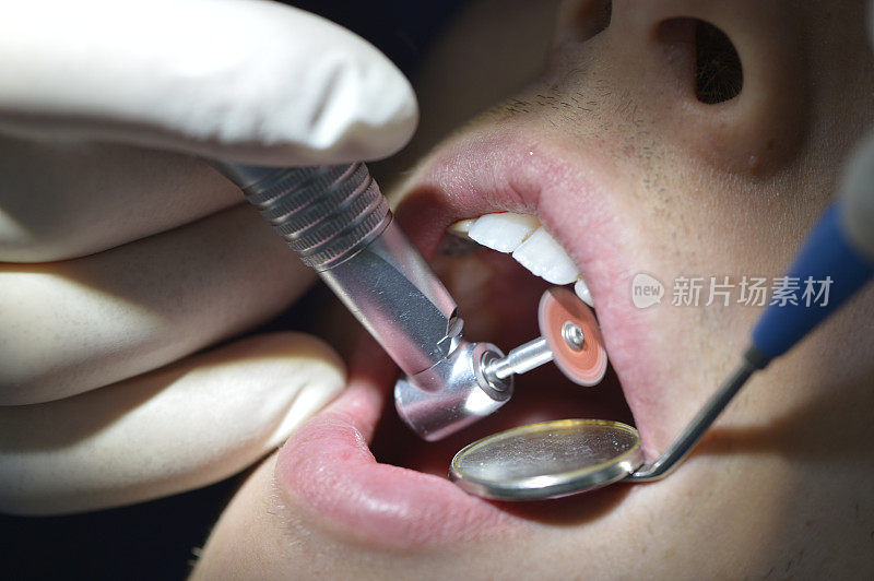 牙齿外科手术