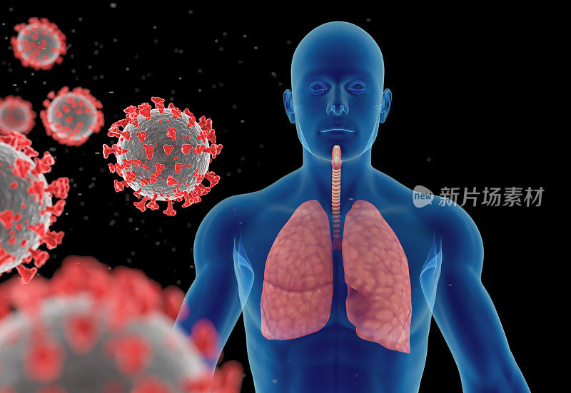 冠状病毒、病毒性肺炎或流感病毒感染的3D插图
