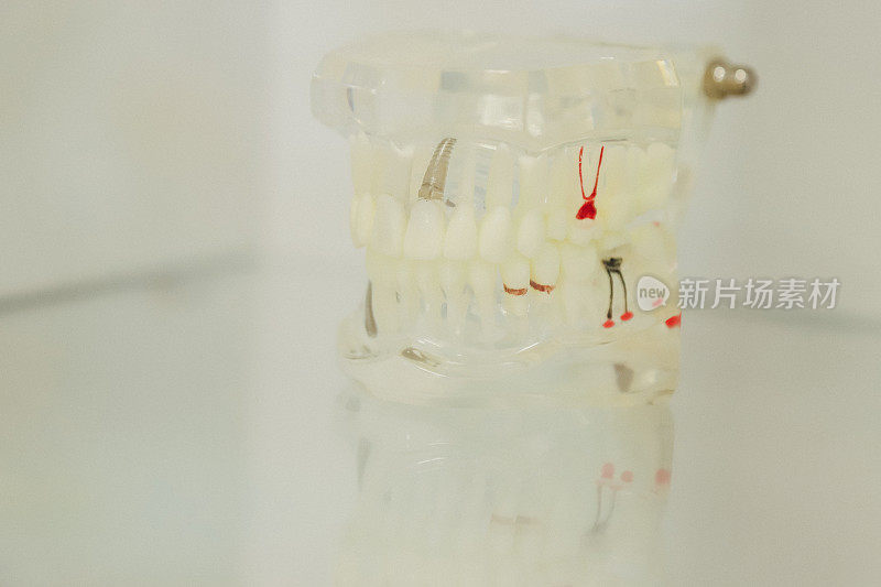 模型的塑料牙齿。如何正确刷牙。孤立在白色背景上。牙科保健和医疗指导的概念。