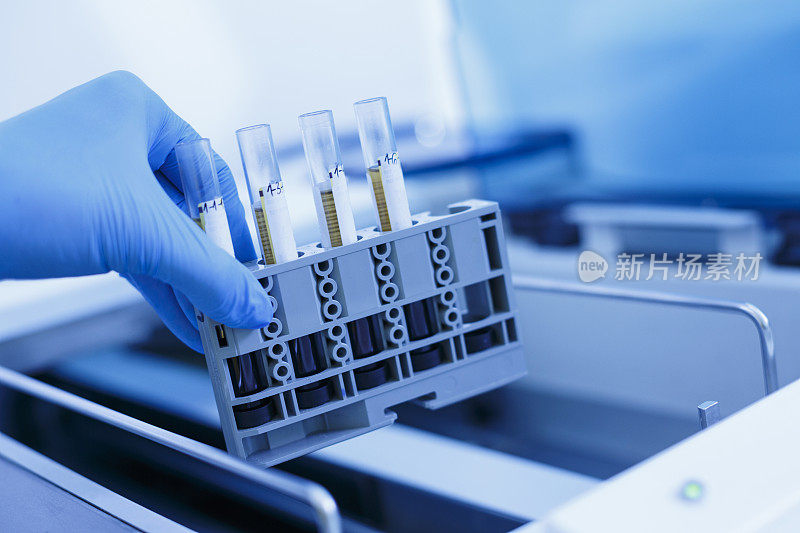 冠状病毒COVID-19病毒。实验室里的医学研究在实验室使用现代设备处理医学样本的科学家。医疗实验室设备用于分析的医疗设备。