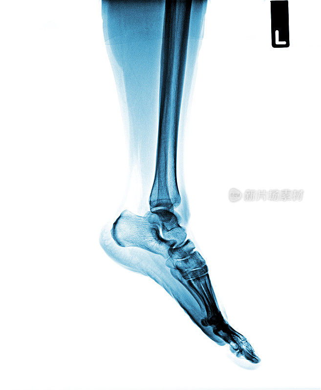足部正常x光。侧面图