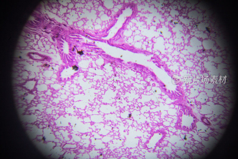 显微镜下兔肺横切面
