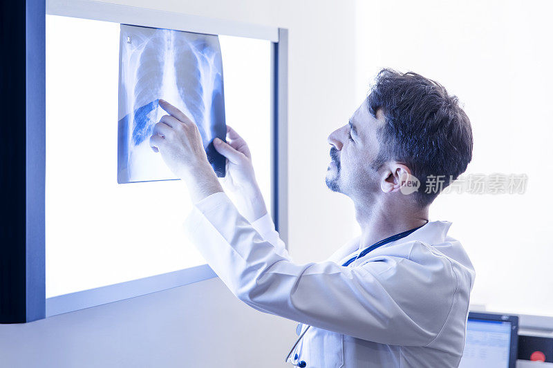 医生在看肺的x光片