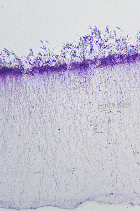 青霉菌在显微镜下
