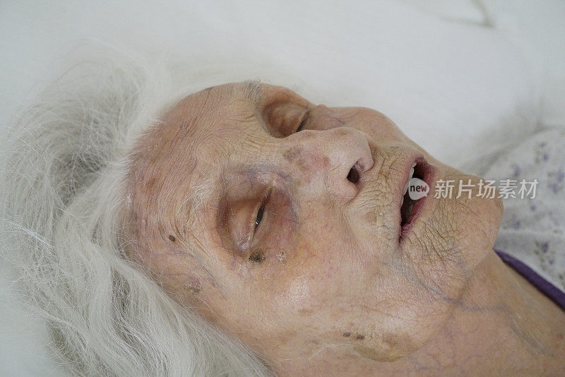 精神错乱的老年女性躺在医院里
