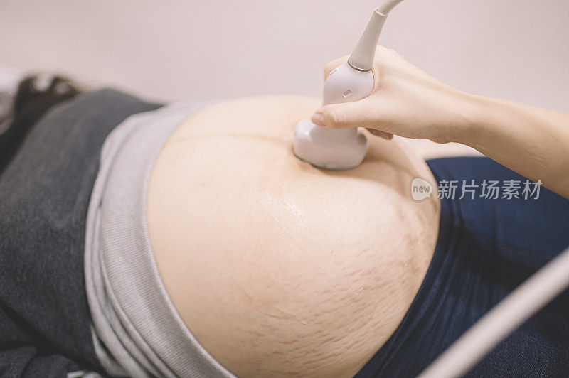 一名亚裔华人女医生为一名亚裔华人孕妇做超声检查。未来妈妈肚子上的产科医生移动传感器