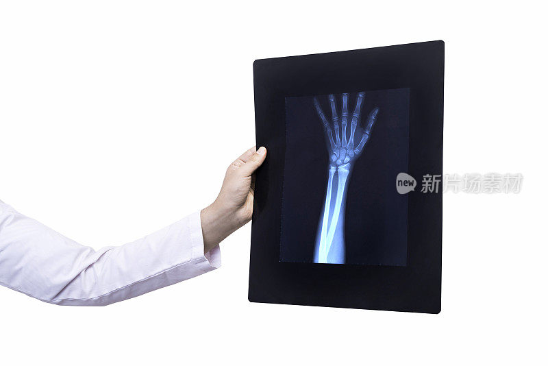 难以辨认的骨科医生在白色背景下拿着一只人手的x光结果